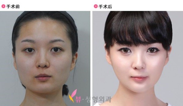 Chùm ảnh: Gương mặt hoàn hảo sau phẫu thuật thẩm mỹ của các cô gái xứ Kim Chi 8