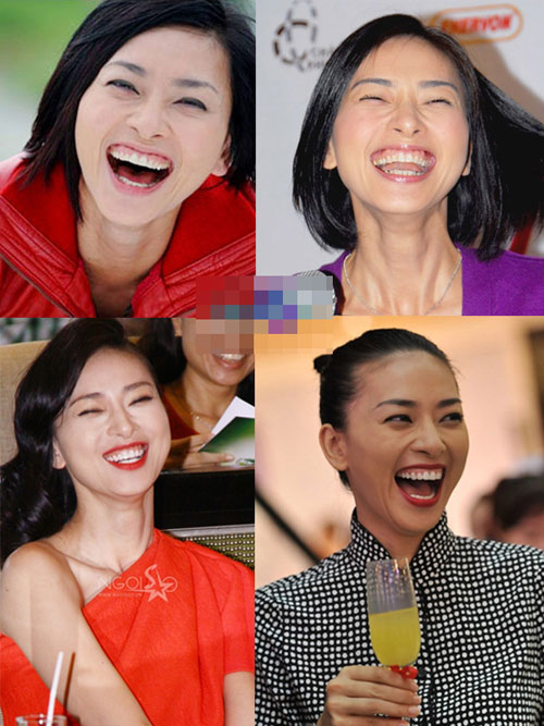 Những nụ cười hở lợi kém duyên "dìm hàng" sao Việt 1