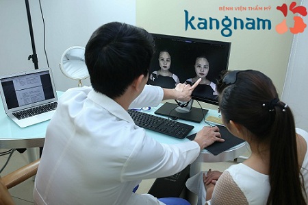 phẫu thuật gọt cằm V line 3d 1