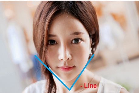 Cằm v line 1