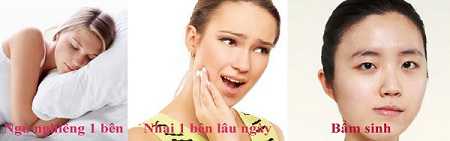 khac-phuc-mat-bi-lech-1